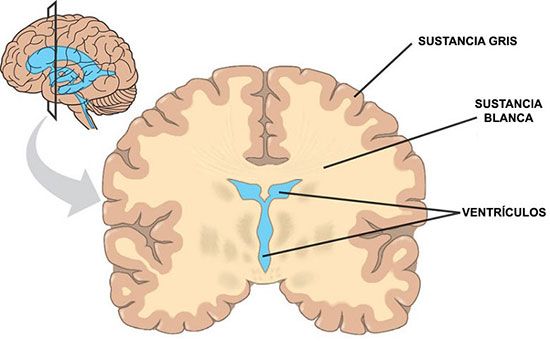 EMDR y el aumento de la materia gris en el cerebro / Gabriel Malina